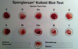 Spenglersan-Kolloid-Bluttest
